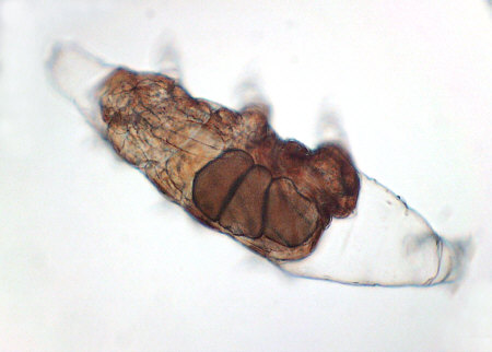 [ tardigrade Milnesium tardigradum during egg deposition ]