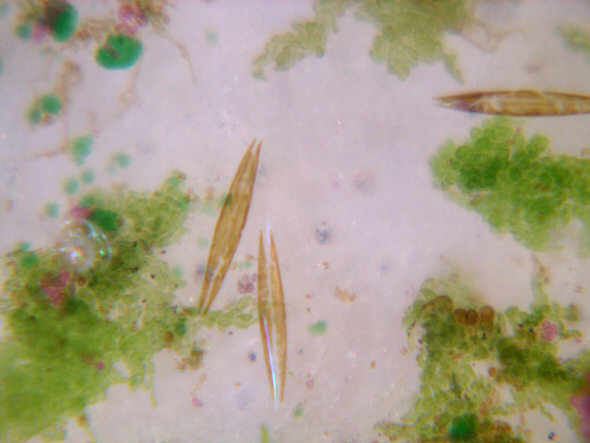 [ Diatoms in a sand sample from the Kiel Bay,Germany ]