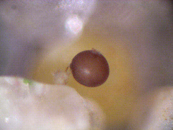 [ Worm egg anchored to a sand grain. Sand sample from the Kiel Bay, Germany ]