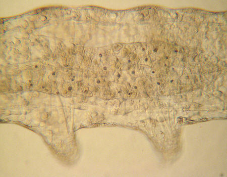 [ stomach region of a tardigrade ]
