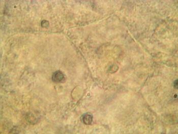 [ stomach region of a tardigrade, detail ]