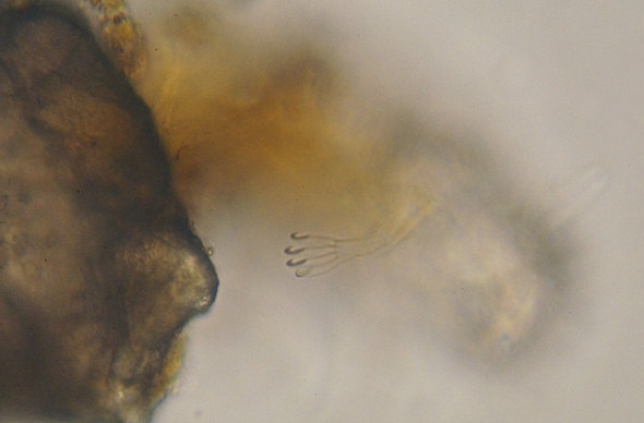 [ marine tardigrade, photographed by means of the trinocular BTC BIM135T microscope]