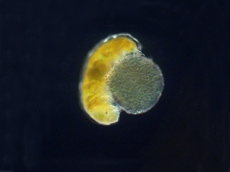 [ tardigrade playing (?) with alga ]