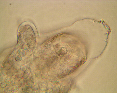 [ Tardigrade; asphyctic state ]