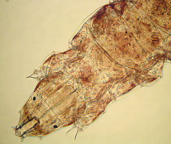 Water Bear Mouth