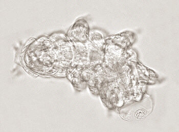 [ Tardigrade (tardigrada) during moulting ]