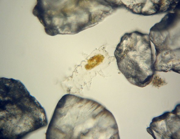 [ Baltic Sea tardigrade cuticula, desposited after moulting ]