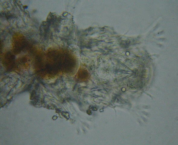 [ Marine tardigrade from Mali Losinj ]