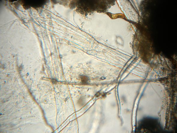 [ Microscopic view of the river flood water sample ]