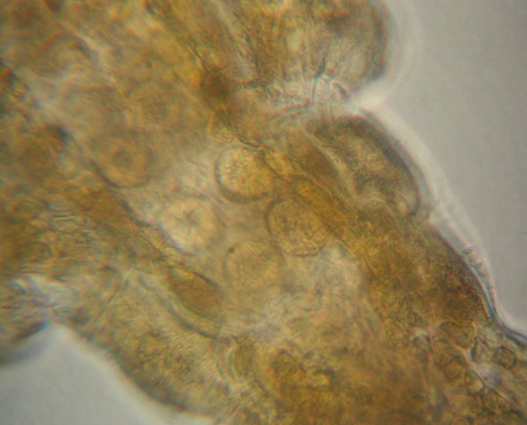 [ Tardigrade from the Isar river flood water sample, detail ]
