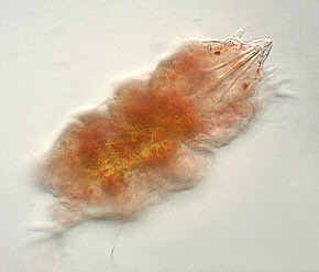 [water bear tardigrade tardigrades echiniscus jpg photomicrograph]