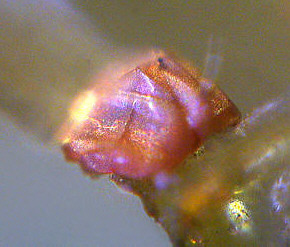 [water bear tardigrade tardigrades echiniscus jpg photomicrograph]