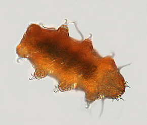 [water bear tardigrade tardigrades echiniscus jpg photomicrograph]