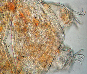 [water bear tardigrade tardigrade echiniscus jpg photomicrograph]