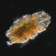 [tardigrades #1: 'Echiniscus' water bear with red eyes -- rot&auml;ugiger 'Echiniscus'-Wasserb&auml;r]