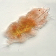 [tardigrades #7: young 'Echiniscus' water bear -- Junger Wasserb&auml;r]