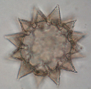 [waterbear egg, focus level 3]