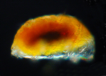 [ Echiniscus tardigrade during moulting ]