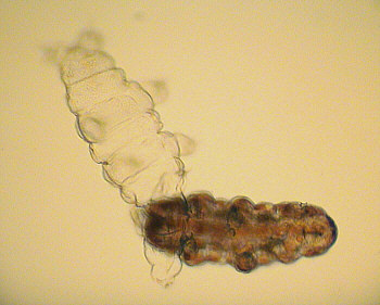 [ Moulting, final stage ]