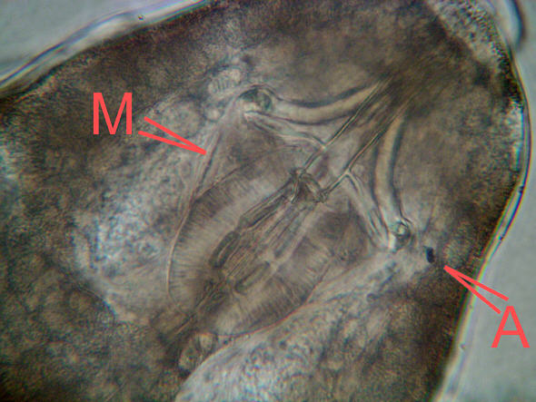 [ Macrobiotus tardigrade (Tardigrada) ]