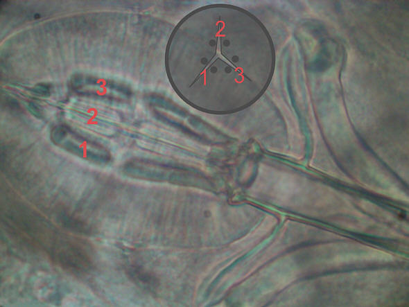 [ Macrobiotus tardigrade (Tardigrada) ]