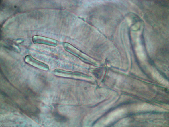 [ Macrobiotus tardigrade (Tardigrada) ]