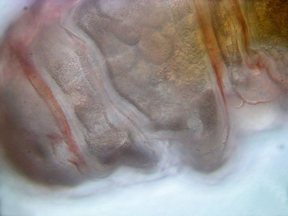 [ Macrobiotus tardigrade (Tardigrada) ]