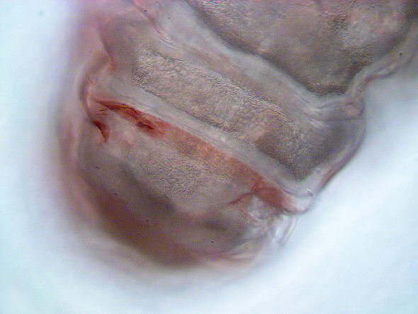 [ Macrobiotus tardigrade (Tardigrada) ]