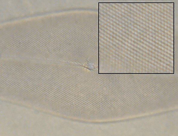 [ TWX-1 Pleurosigma-Test ]