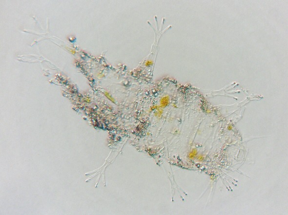 [ Cuticula eines B&auml;rtierchens von der Insel Losinj ]