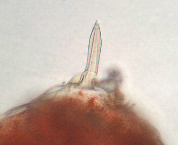 tardigrades tardigrada b&auml;rtierchen detail echiniscus