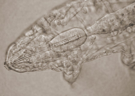 [ Diphascon B&auml;rtierchen (Tardigrada)]