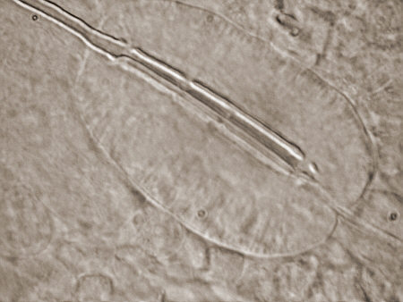 [ Diphascon B&auml;rtierchen (Tardigrada)]