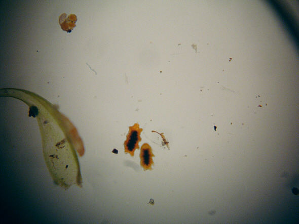 [ View through the WebCam loupe ]