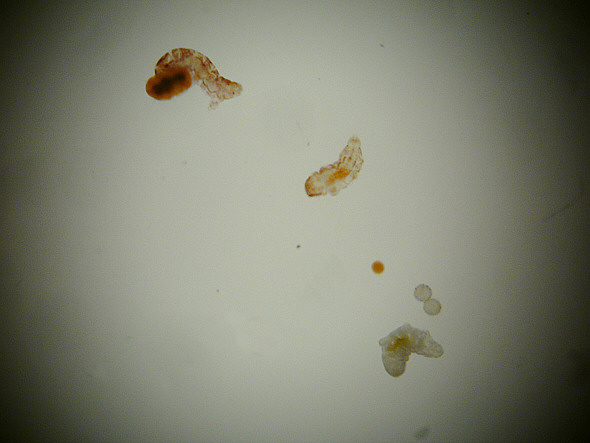 [ Blick durch die Webcam-Lupe ]