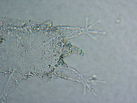[ Thai cuticula: lateral lobes ]