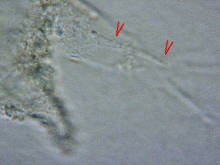 [ Thai cuticula: long spurs on the hind legs ]