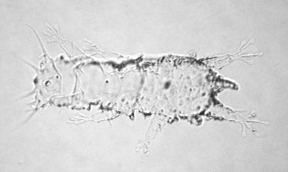 [ Thai cuticula ]