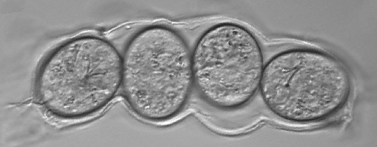 [Gelege von Milnesium tardigradum]