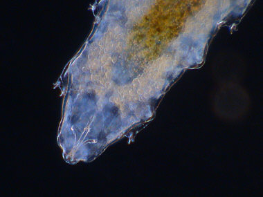 [Macrobiotus areolatus ?]