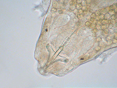 [Macrobiotus water bear (jpg)]