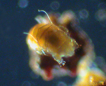 [ Tardigrade Tardigrades B&auml;rtierchen ]