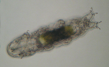 [ Dactylobiotus dispar, Tardigrade, Totale ]