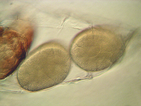 [ B�rtierchen Milnesium tardigradum, Gelege ]