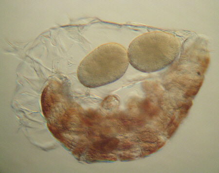 [ B�rtierchen Milnesium tardigradum, Gelege ]