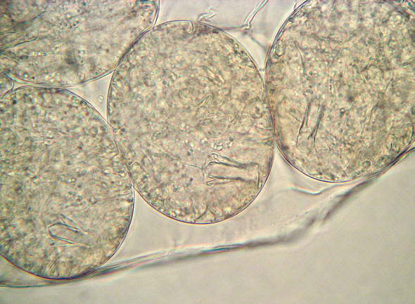 [ B�rtierchen Milnesium tardigradum, Gelege ]