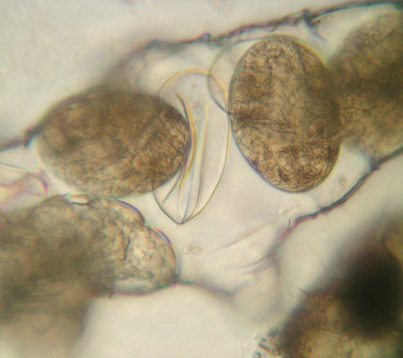 [ B�rtierchen Milnesium tardigradum, Gelege ]