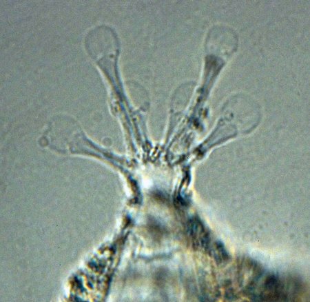 [ Hinterbein eines Batillipes Tardigraden aus sandigem Meeresgrund ]