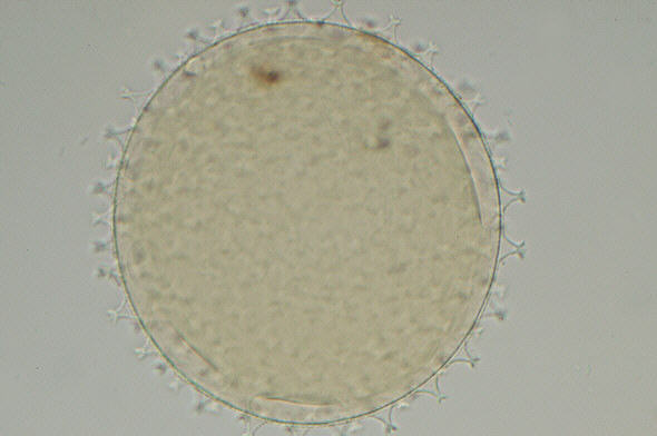 [ Vergleichsaufnahme 40er Apo  ]