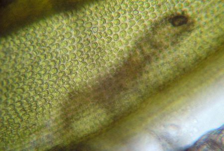 [ Eutardigrade behind moss leaf, transmitted light ]